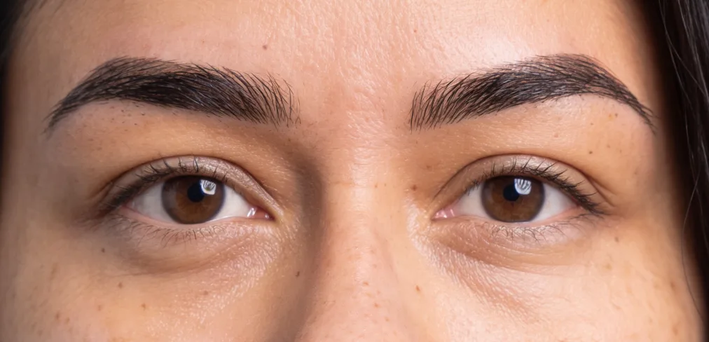 Combo brows healed at eight weeks, second client