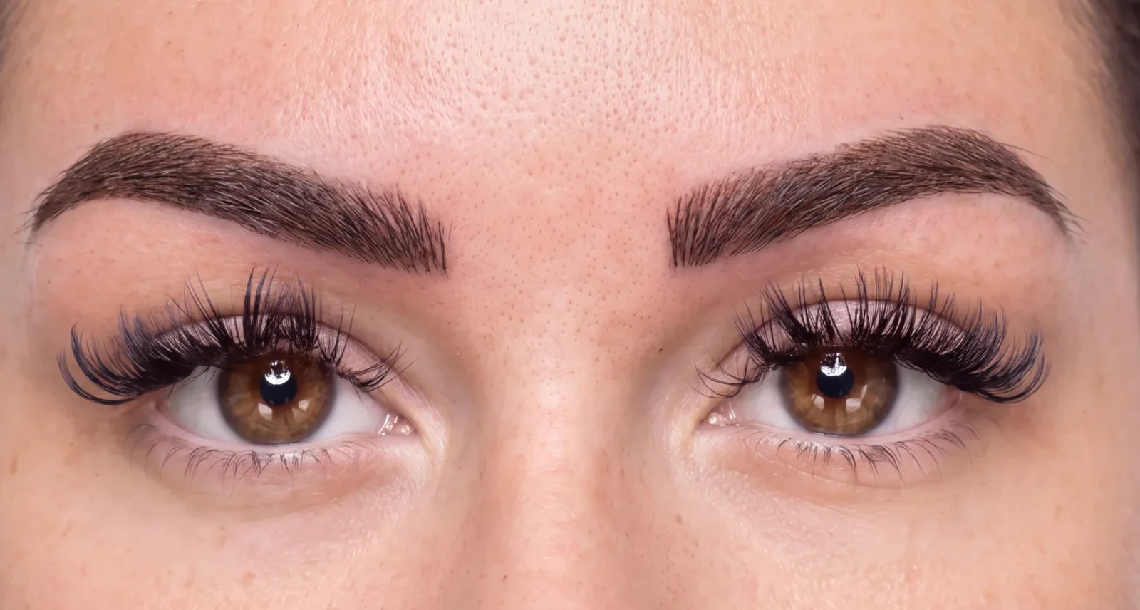 Combo brows healed at eight weeks