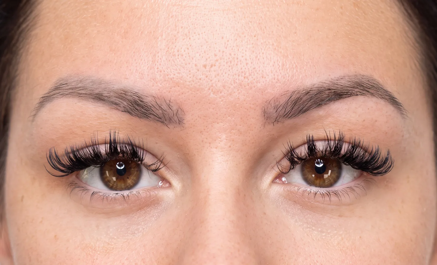 Brows before combo treatment